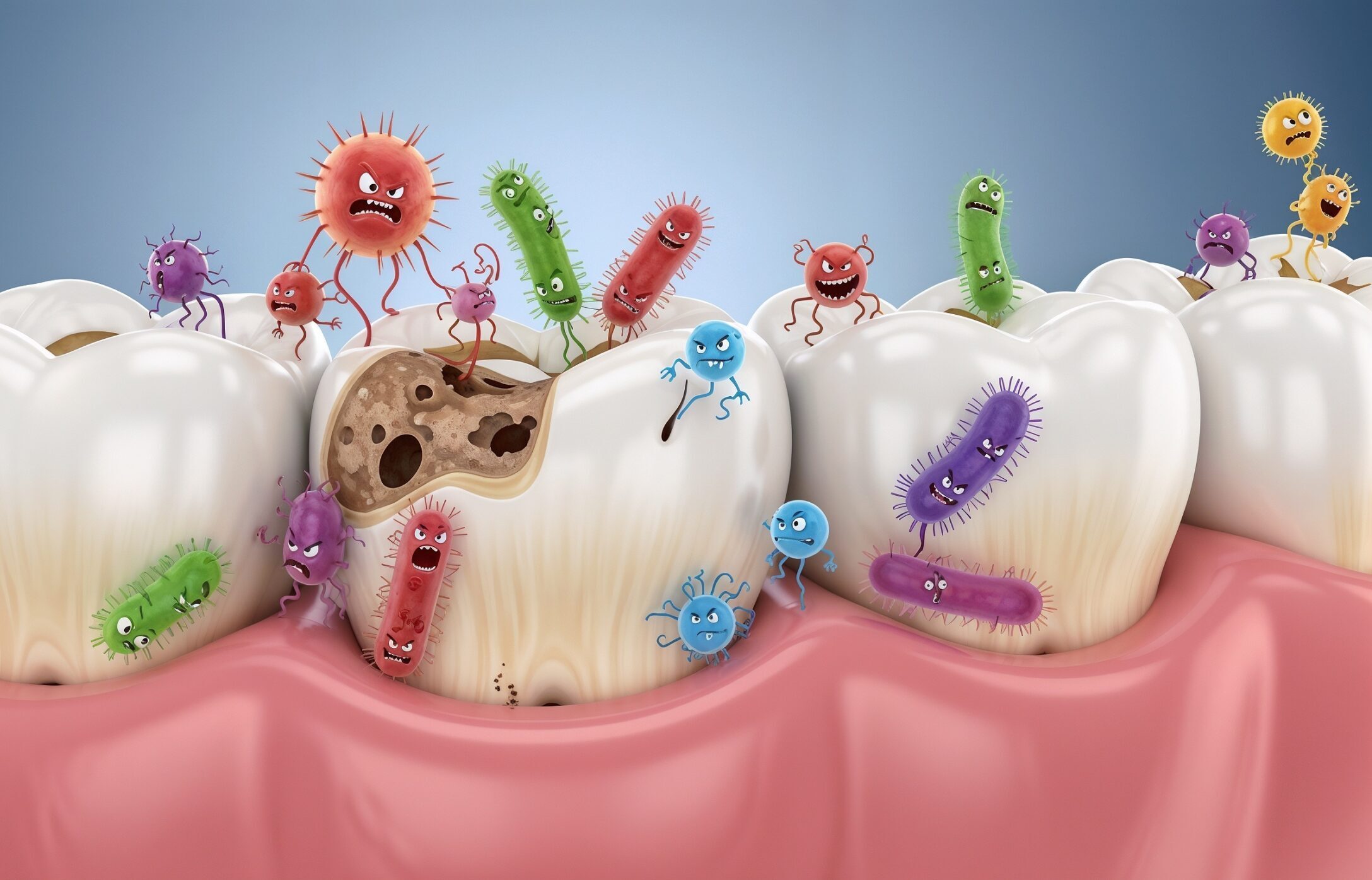Parodontitis und Karies können Schlaganfälle und Herz-Kreislauf-Ereignisse begünstigen