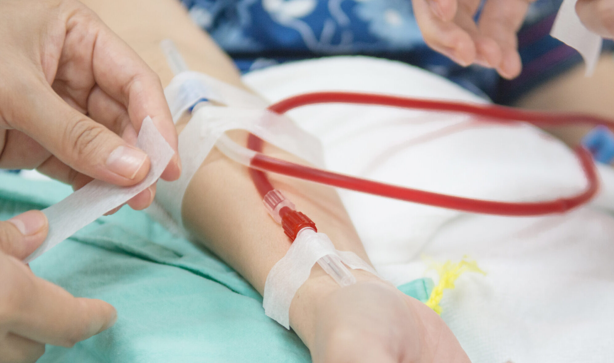 Hemodialysis machines with tubing.,transplantation,medical equipment concept.