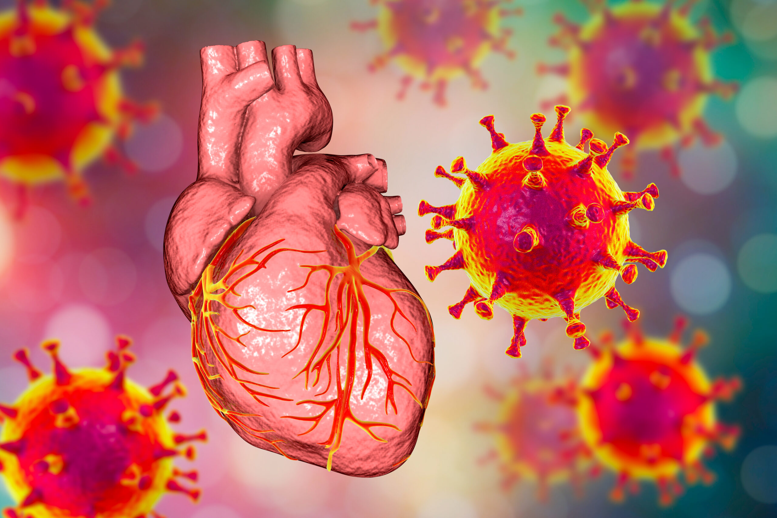 COVID-19 viruses affecting the heart, conceptual 3D illustration