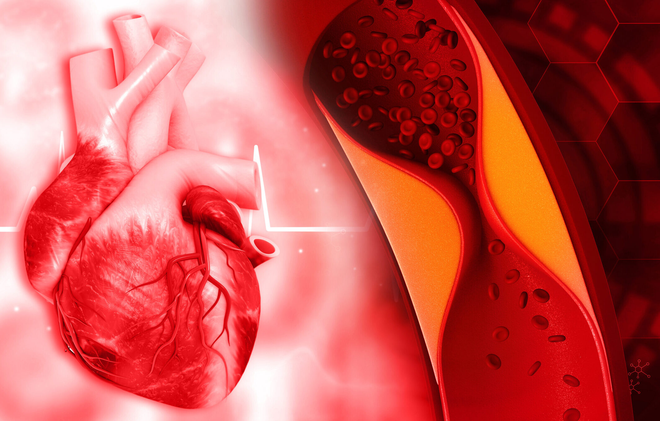 Sichere „Blutfettsenker“: Statine mit deutlich weniger Nebenwirkungen als gedacht